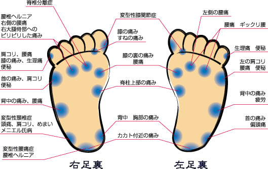 タコから分かる体のトラブル画像