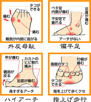 足下のアンバランス画像